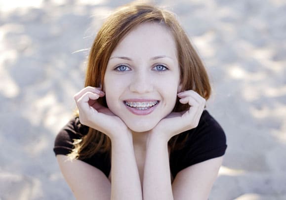 girl with Braces