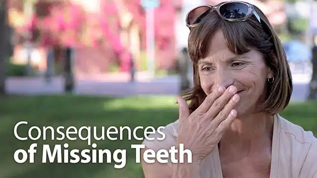 Consequences of Missing Teeth