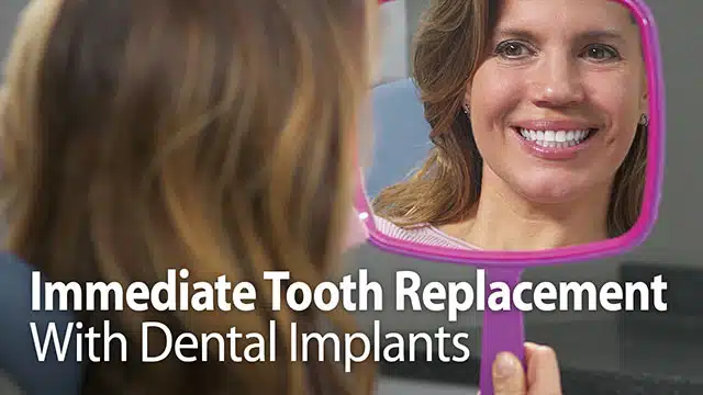 Immediate Tooth Replacement With Dental Implants