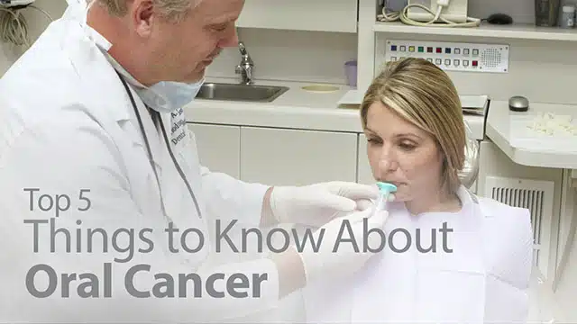 Top 5 Things to Know About Oral Cancer