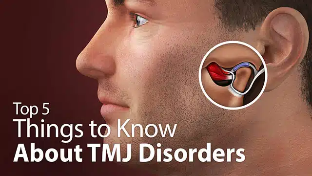 Top 5 Things to Know About TMJ Disorders